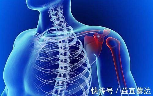 肌肉痉挛|肩膀疼痛难受?不一定是肩周炎!还可能和3种疾病有关,别搞错了