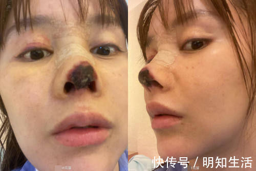 整形|高溜整形失败:整形市场乱象丛生,如此遭遇该谁赔偿?