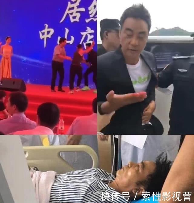 任达华4根手指神经被割断！主治医生：任达华用手挡是对的！