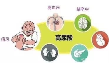  痛风|尿酸高别光吃药，不妨每天吃这几种食物，降低尿酸，痛风不来扰