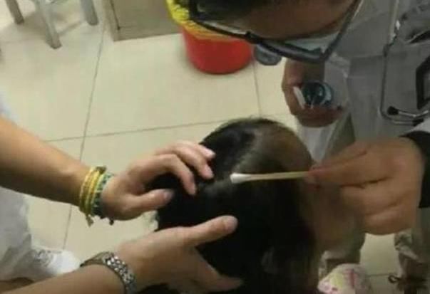 外面玩耍|爸爸给女儿梳头看见“小米粒”,急忙送医检查,医生还好来得早