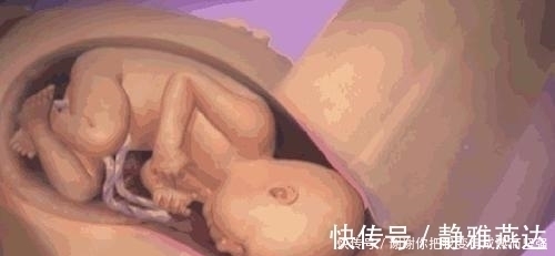 宫缩|临产前胎宝忙得不可开交,为了跟妈妈见面,胎宝默默承担了这么多