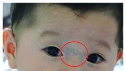 西瓜|3种水果被誉为“烂脾胃王”,孩子常吃?或许脾胃“破烂有洞”