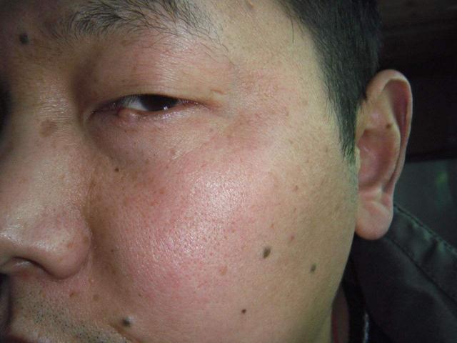 超声波|哪些人容易患冠心病出现这些症状,你可能患冠心病,别不当回事