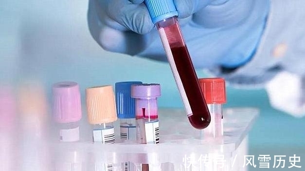 家长|血型也会影响孩子智商?4种常见血型的智商排名,你家孩子在第几