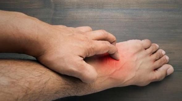 血糖过高|“血糖高足先知”!提醒:脚部若出现3种异常,说明血糖过高了