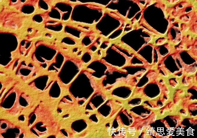 疼痛|为什么更年期的女性出现各种疼痛?该咋办?请看此文,医生告诉您