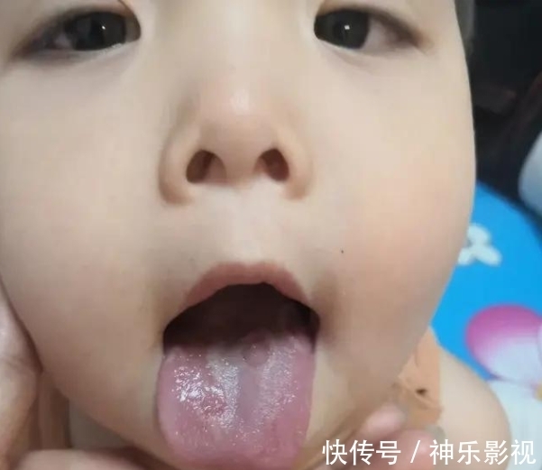酸梅汁|西瓜是小儿缺钙的“发物”?医生:若要脾胃健康,1种食物常吃