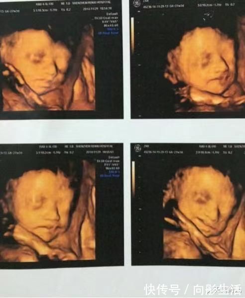 四维|为何有的医院做四维彩超不让家属陪?3大原因,孕妇有权知道
