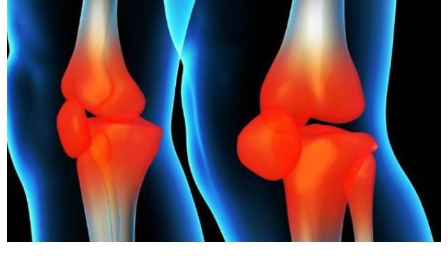 钢骨|吃一口胜过5瓶钙片,骨科主任:敞开吃,骨头愈发紧密,脆骨变“钢骨”