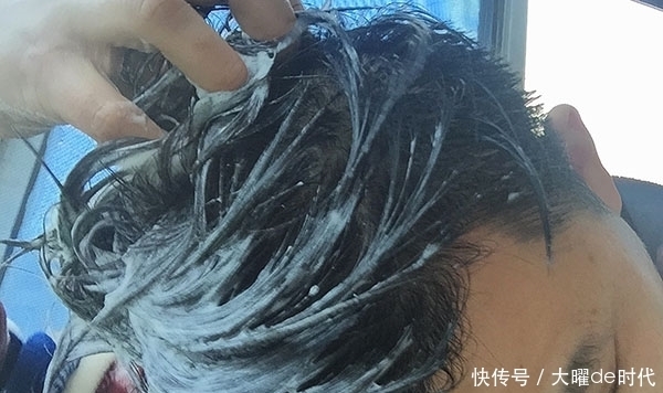 总感觉头上有虫子在爬?是怎么回事?真的有虫子么?