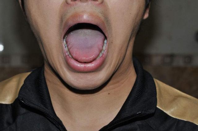 超声波|哪些人容易患冠心病出现这些症状,你可能患冠心病,别不当回事