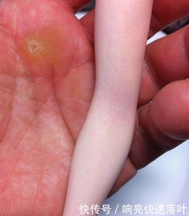 血管|日本匠人做手办,逼真到血管都清晰可见,却被人误会是糖王的作品!