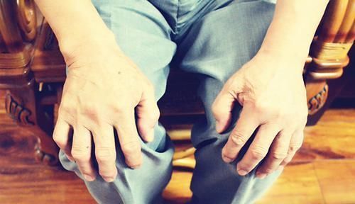 60歲后的老人,體重多少才健康醫(yī)生:體重過(guò)輕,要當(dāng)心2種病