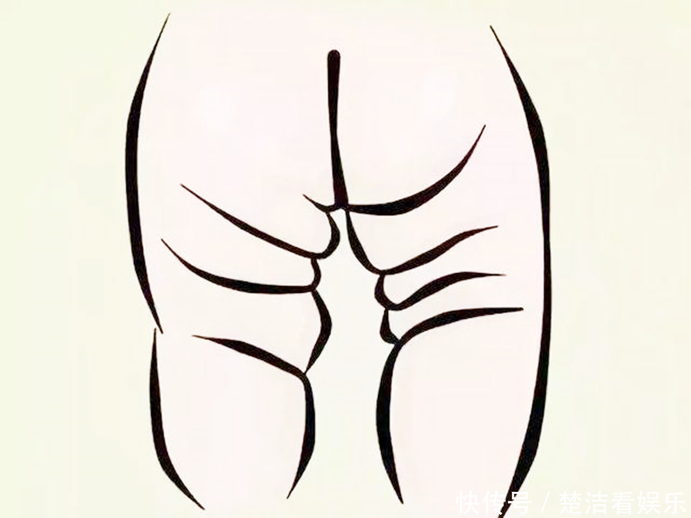 宝宝的臀纹腿纹不对称?一岁前要当心些,排除原因才安心