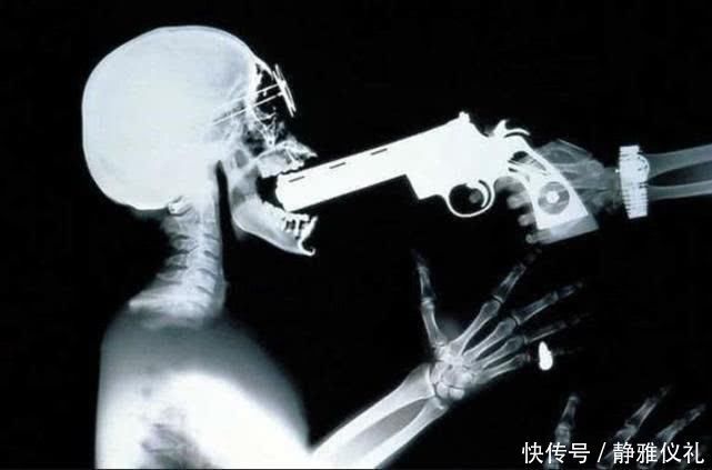 摄影 X光的世界到底长什么样杰克逊太空舞步,接吻让人哭笑不得