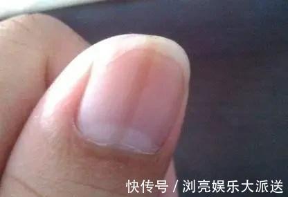 代谢|肝不好，脚部会有3种异常，若你全中，可能是肝“撑不住了”