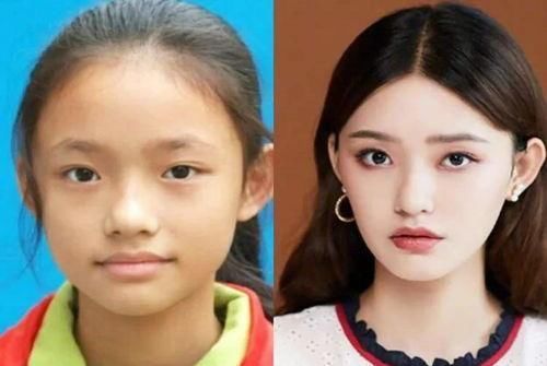 女孩脸上有这5种“美人线”，小时候再丑也不怕，女大定会十八变