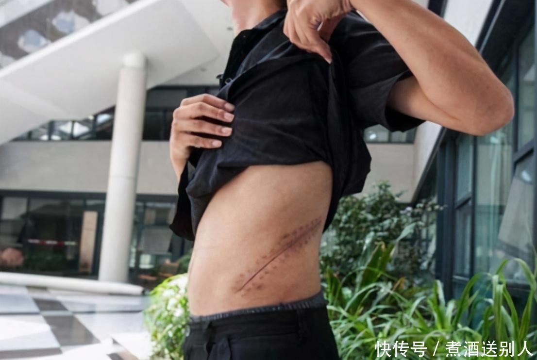 年前|9年前,2万“卖肾”买苹果手机,如今他正在为年轻“买单”