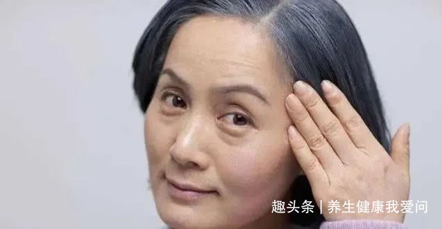 高血脂|寿命短的女人,手上会发出3种信号,若一个不占,说明你还算健康