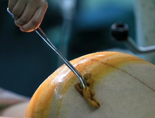 首例|23年过去,每天消耗42瓶奶粉52片尿布的世界首例七胞胎,咋样了?