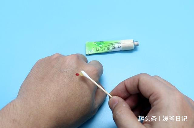 红霉素软膏|红霉素软膏除了药用,还有5个妙用也很棒,叮嘱家人知道,很实用