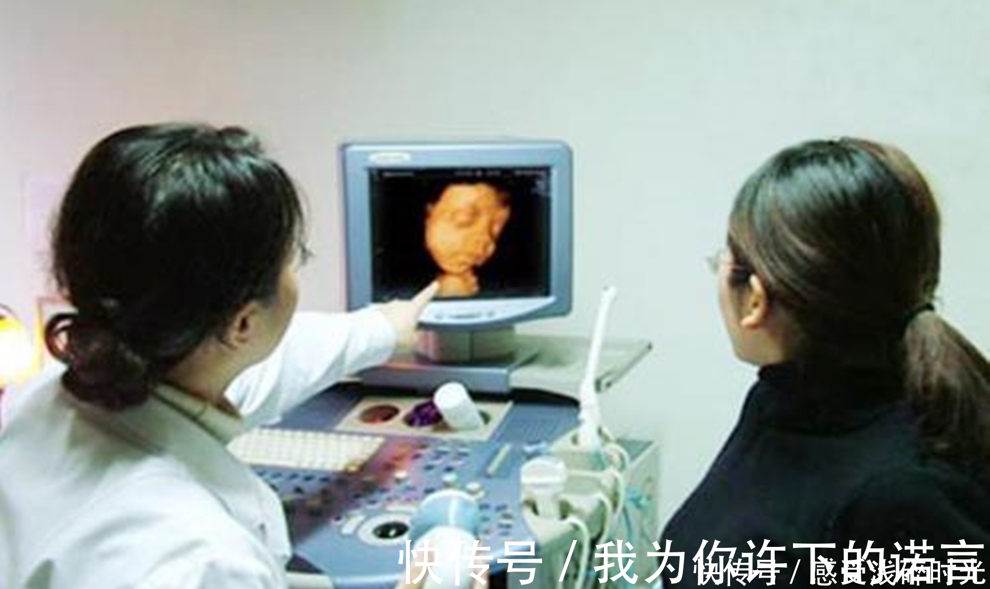 相似度|宝宝的四维彩超和出生后的模样差异大吗?这种正面照,相似度80%