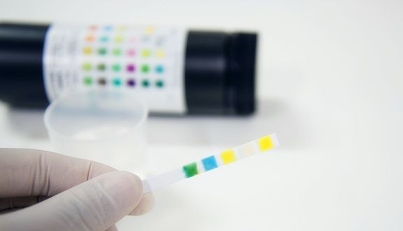 血糖|糖尿病患者的尿又黄又骚是什么原因？你真的知道吗？看专家的理解