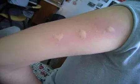 蚊子咬的满身是包,赶紧在阳台摆三种绿植,驱蚊效果好小孩更安全