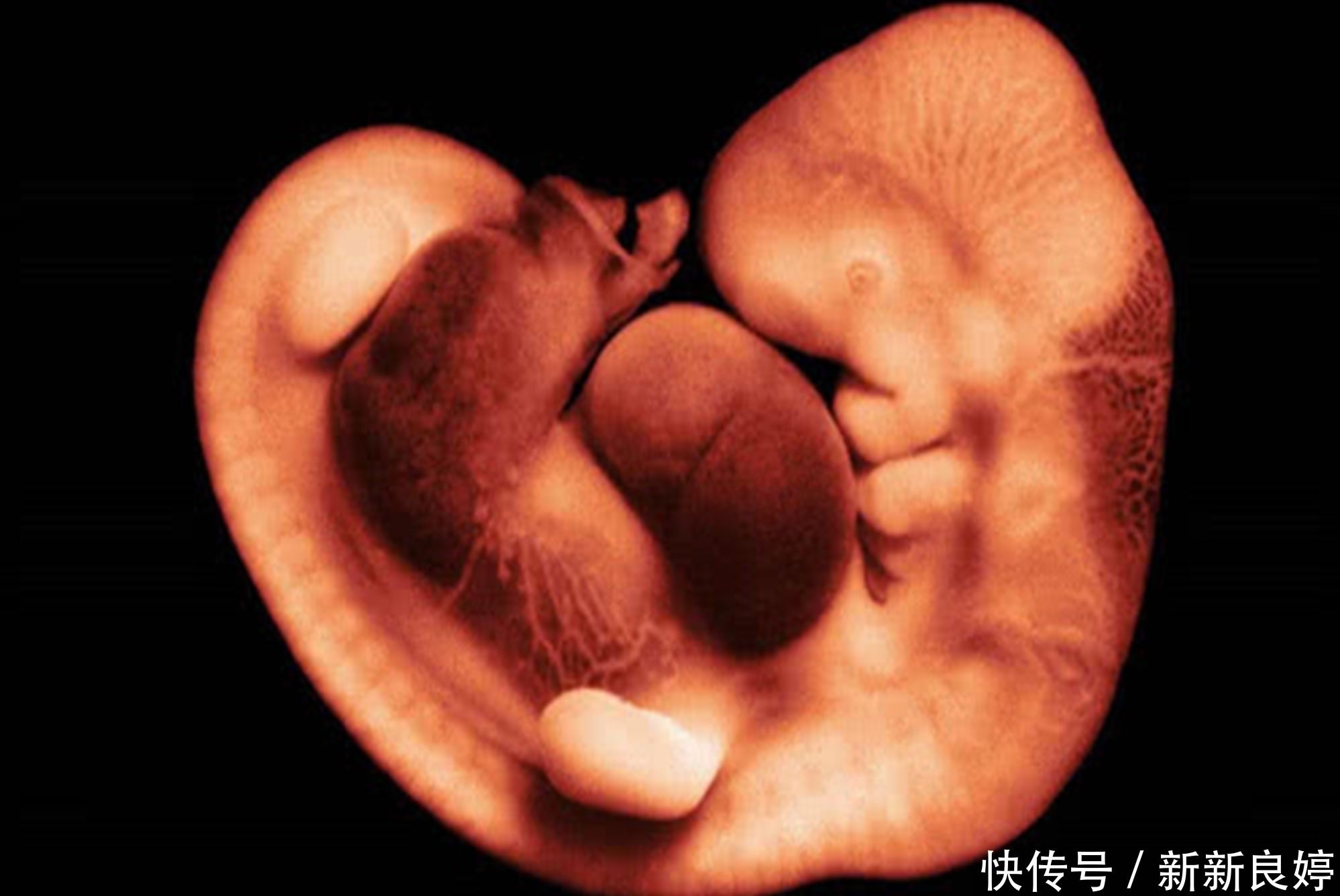 指标|孕期B超单上四个指标,暗示胎儿健康信号,达标孕妈可以放心了