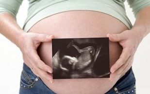 宝宝|孕妈害怕胎儿脐带绕颈？那就避开不好的行为，或许能降低绕颈概率