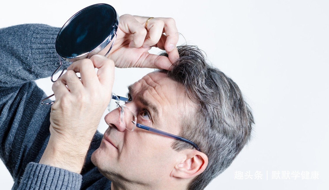 血热|白发多显人老两味药去白发，四百年前的老方子，不该被埋没！