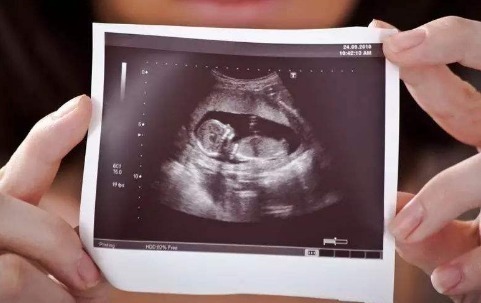 子宫|孕期这几种常见“痛”,是胎儿健康发育信号,别一痛就着急去医院