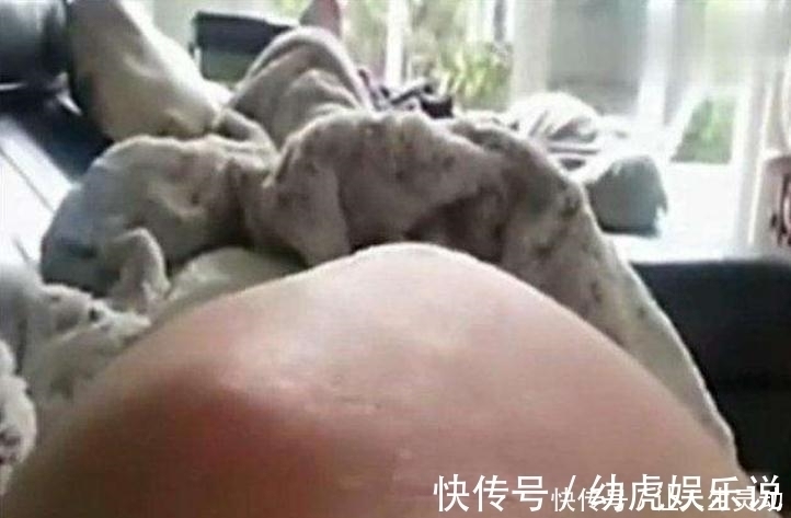 宝宝|胎儿没出生就脐带断裂,医生也无能为力,孕妈抓住宝宝求救信号