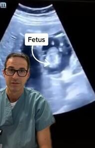病例|加拿大医生分享罕见病例：女子怀上“心肝宝贝” 胎儿长在肝脏里