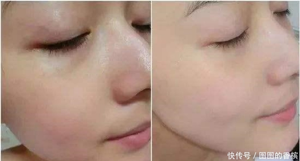 专治色斑的好物居然是香菜?难怪很多美女都在偷偷用,我先收藏了