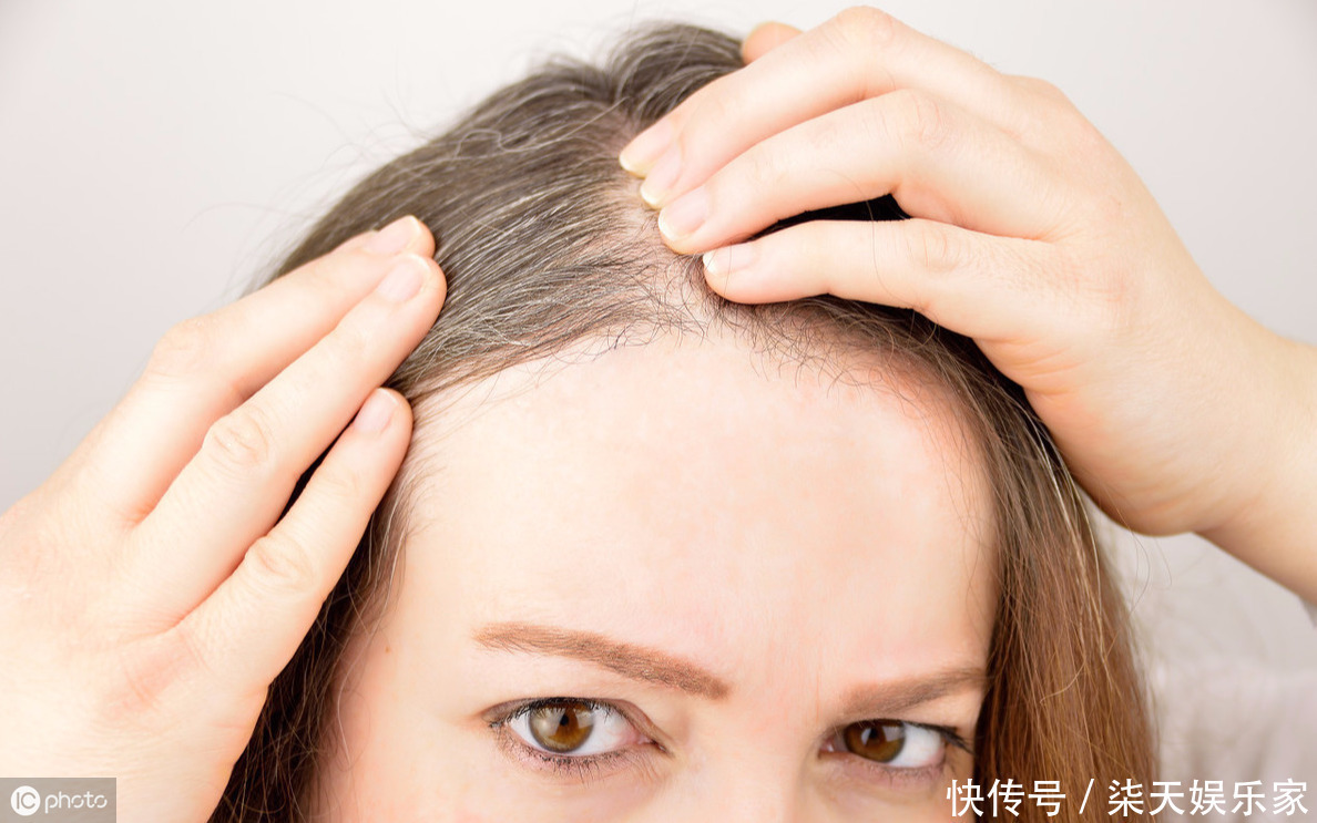 白發長在哪，病就從哪兒來，堅持做好4件事，頭發變黑不用染