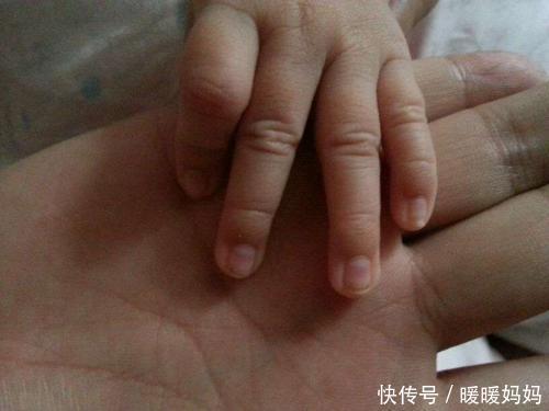 脐带|“最着急新生儿”火了!刚剪完脐带就要“跑”,医生都差点没抓住