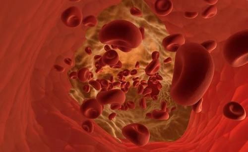 酵液|高血脂患者,一日三餐照着吃,甘油三酯悄悄降,血脂平稳不升