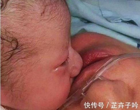 婴儿|婴儿出生妈妈没挺住,宝宝第一次睁开眼,下一刻感动了整个医院