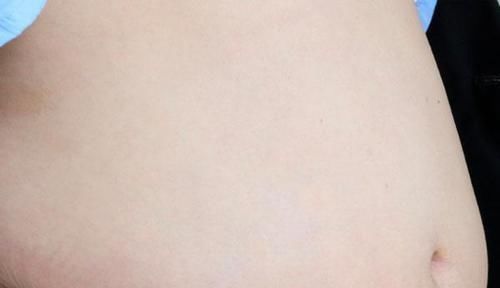 泥垢|肚脐眼里面的黑泥,怎么那么臭为什么还不能直接用手抠