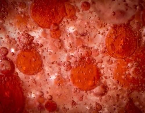 海带|降血脂“榜首”公布了,不是海带而是它,早晚来一点,告别高血脂