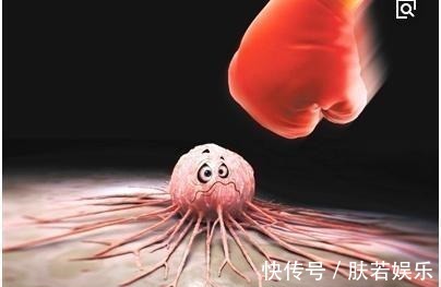 患癌|49岁患癌,3个正确的做法,让他带癌生存了10年