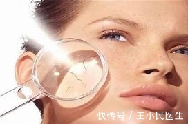 眼膜 王小民教授:为什么眼周很容易出现皱纹?