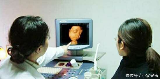 彩超|迫不及待想看孩子,四维彩超时宝宝却比个“v”,医生忍不住笑了