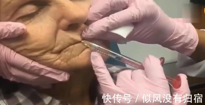 老妇人|老妇人嫌自己的脸太老,希望变得年轻,竟然去医院整容