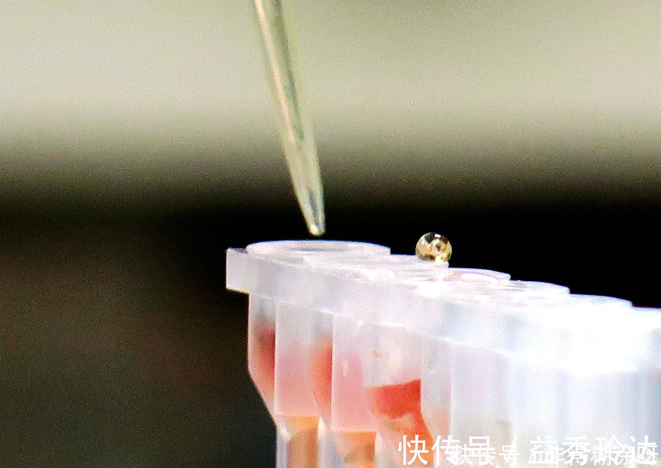 血管|转告父母:低密度脂蛋白高,常吃1“蔬菜”,血管不堵有弹性