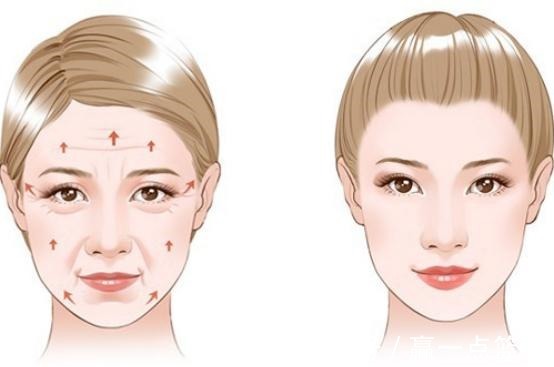 手术 40多岁大姐小拉皮手术全过程分享!