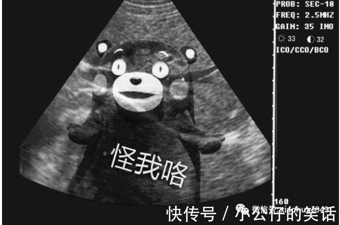 |幽默笑话:刚怀孕,妈妈却说·