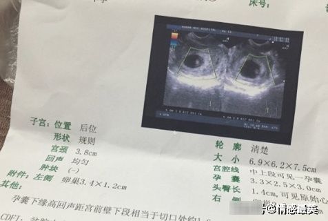 孕囊|彩超单上的数据,或许跟胎儿性别有关,看完你就知道了,值得一看